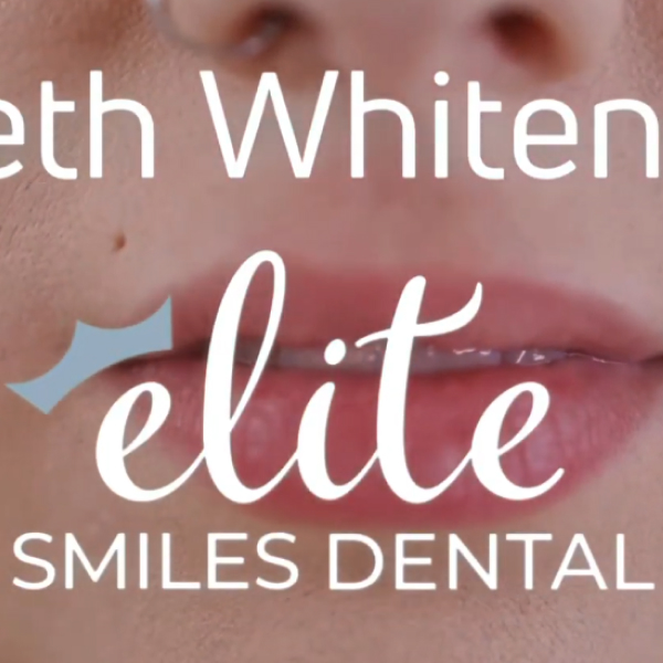 Teeth Whitening video thumbnail